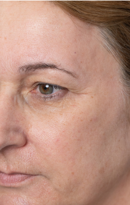 Image d’avant/après